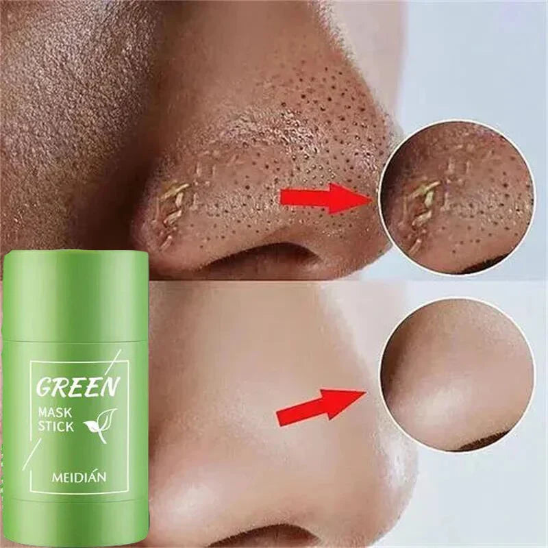 Original Green Tea Facial Blackhead Remover – Solid Mask for Acne, Blemishes, and Pore Shrinking Skin Care